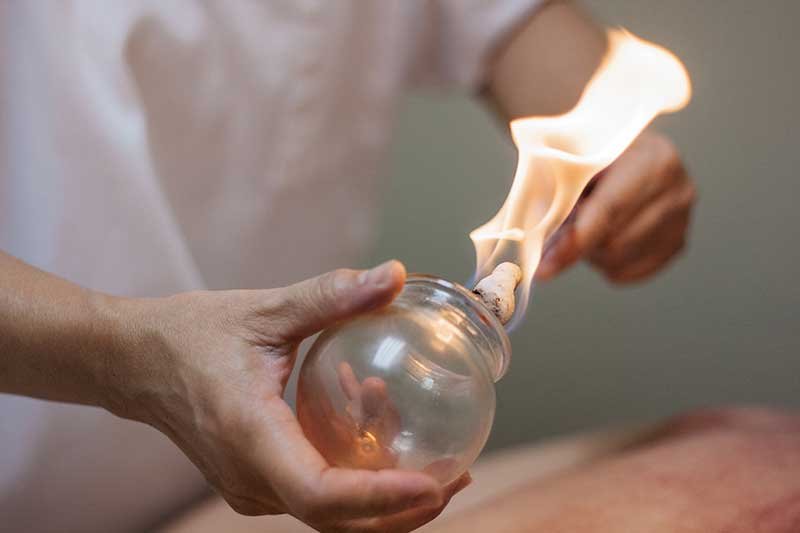 cupping treatments in camp hill